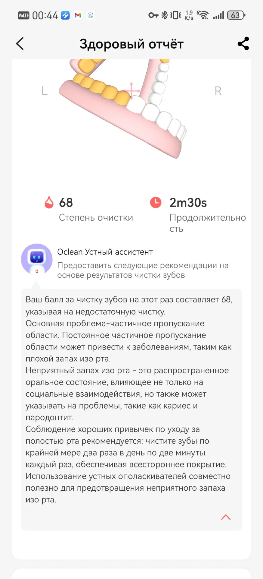Тест-драйв электрической зубной щётки Oclean X Ultra 20 S