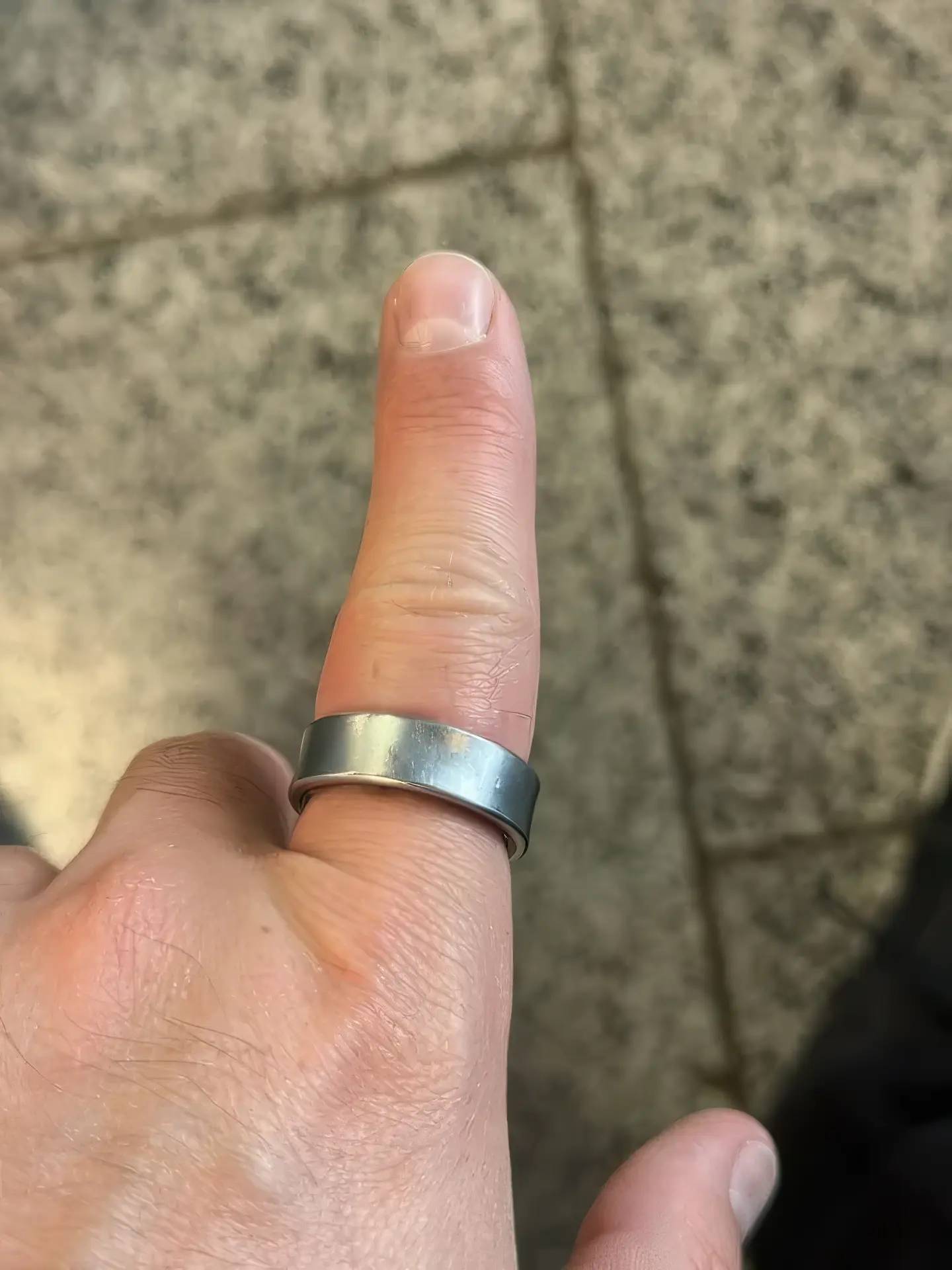 Кошмар наяву: аккумулятор Galaxy Ring вздулся и застрял на пальце владельца. Что делать и насколько это опасно?