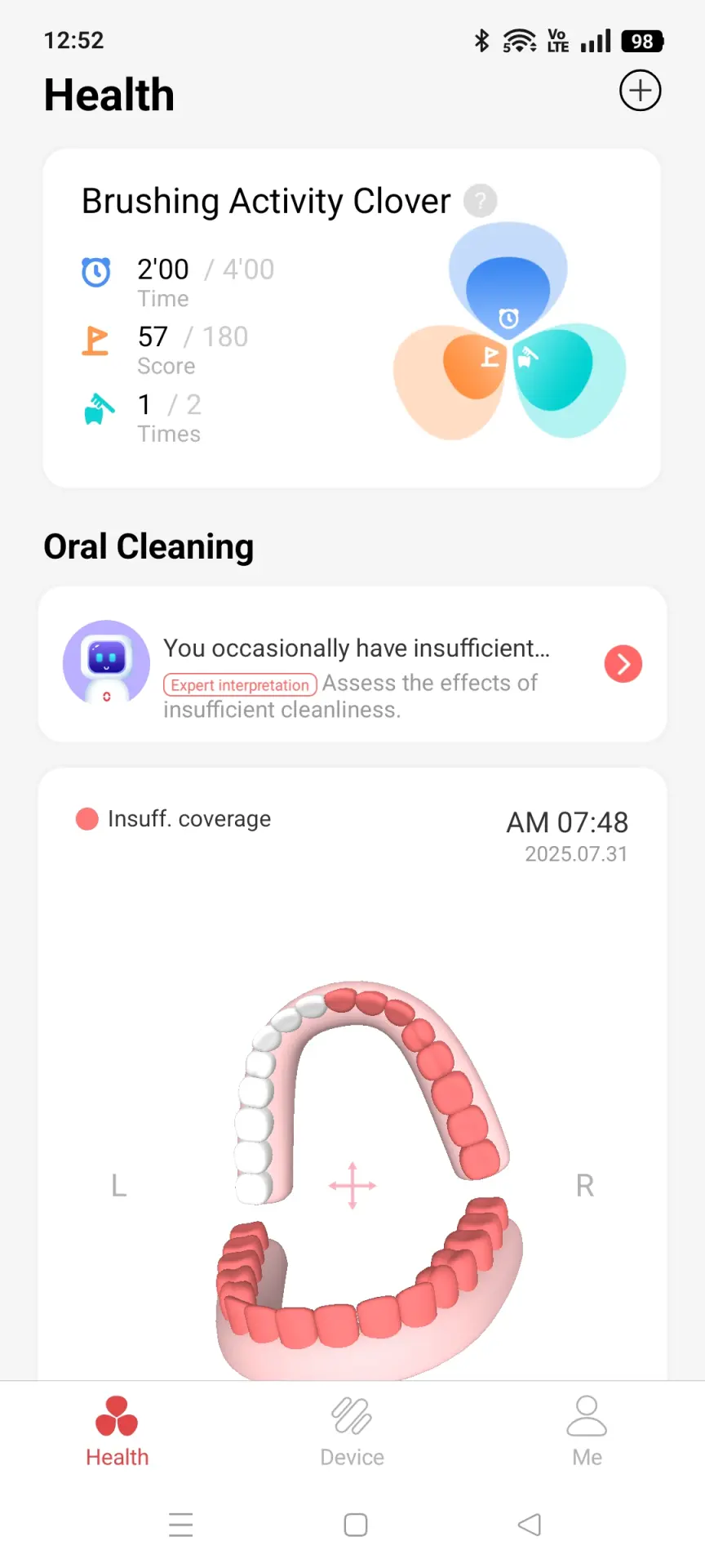 Обзор детской умной электрической зубной щётки Oclean X Kids Pro
